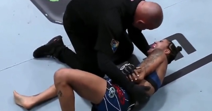 La radiografía revela el codo gravemente lesionado de Istela Nunes después de la dislocación de UFC Vegas 77