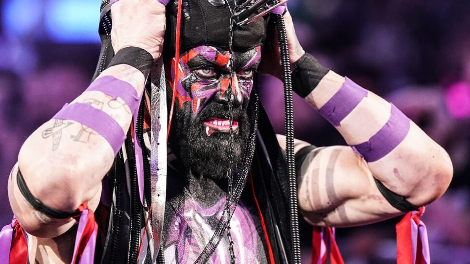 La estrella de la WWE Finn Balor muestra un enorme hematoma facial 'huevo de Pascua'