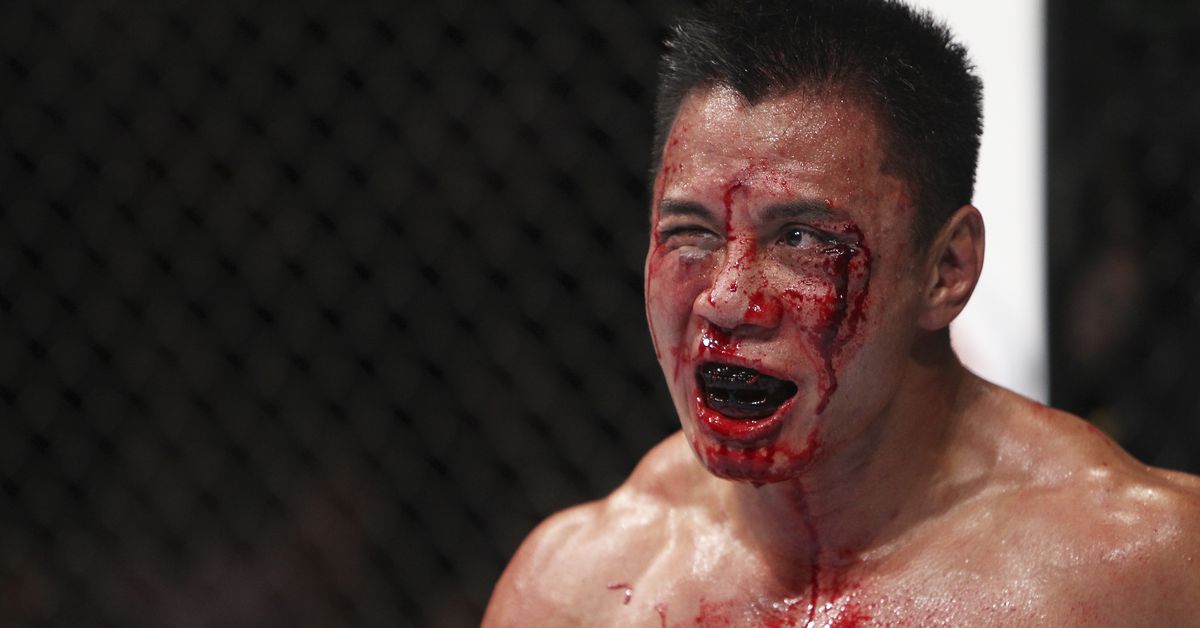 TKO Group Holdings sufrió una pérdida neta de 249,5 millones de dólares en el primer trimestre de 2024, en gran parte debido al acuerdo antimonopolio de UFC.