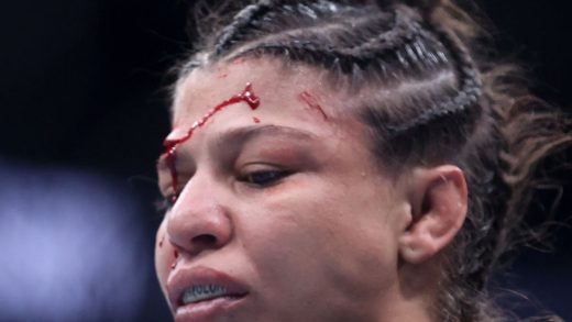 Mayra Bueno Silva comparte imagen de herida en la cabeza suturada de UFC 303