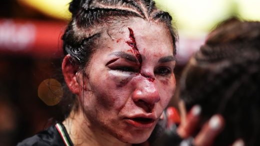 Irene Aldana ofrece actualización luego de que le retiraran los puntos de su horrible corte en UFC 306