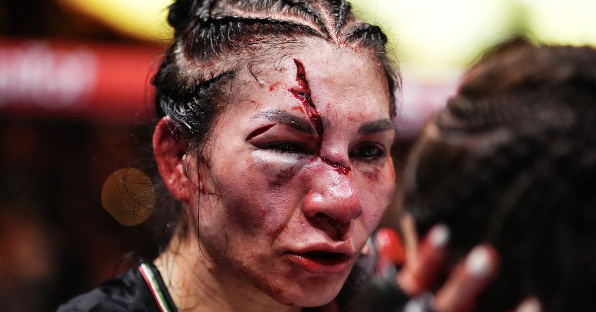 Irene Aldana ofrece actualización luego de que le retiraran los puntos de su horrible corte en UFC 306
