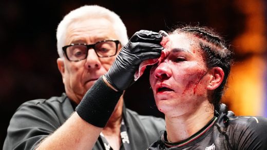 Irene Aldana muestra una recuperación milagrosa de extensas lesiones faciales en UFC 306