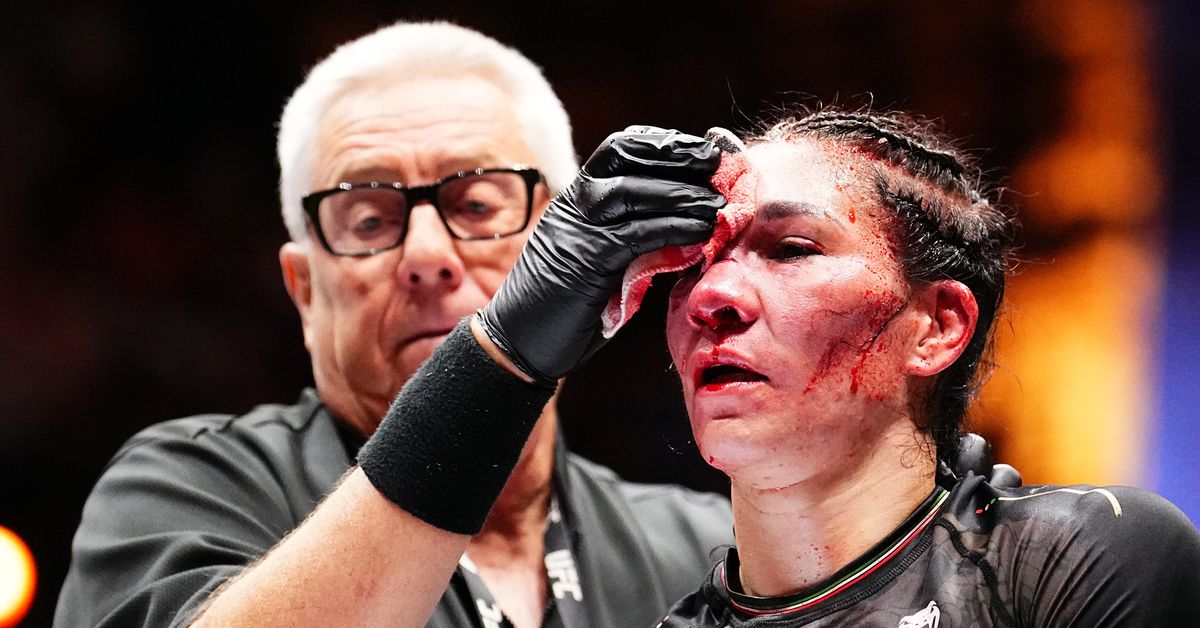 Irene Aldana muestra una recuperación milagrosa de extensas lesiones faciales en UFC 306