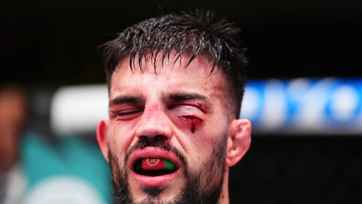 Nasrat Haqparast sufrió un corte horrible durante la ganancia de UFC Vegas 103, Doctor Share antes y después de fotos