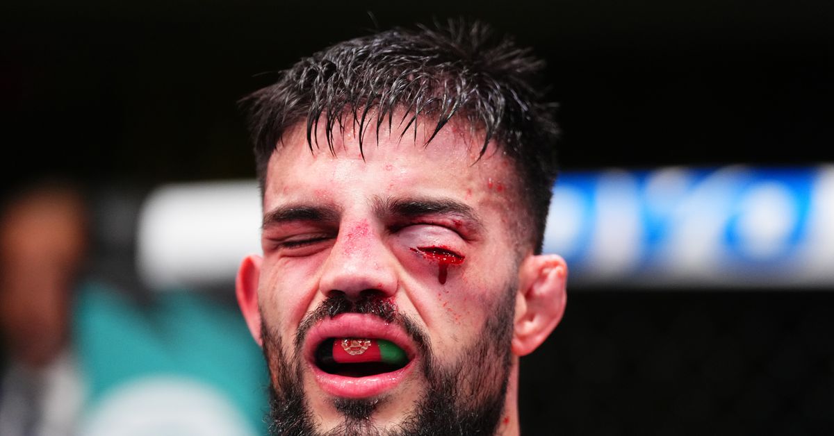 Nasrat Haqparast sufrió un corte horrible durante la ganancia de UFC Vegas 103, Doctor Share antes y después de fotos