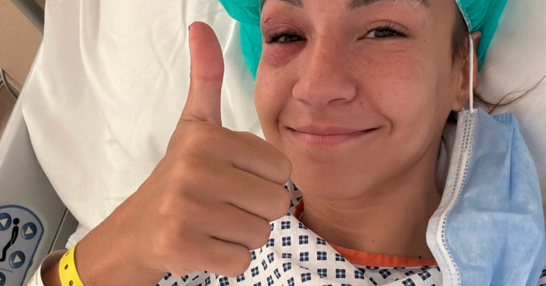 Amanda Ribas se someterá a una cirugía facial después de la placa de metal desplazada del codo Tabatha Ricci en UFC Abu Dhabi: 'Eso me asustó'