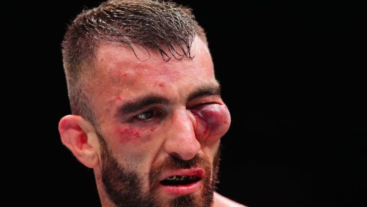 Dana White comparte una horrible foto de lesiones de Mohammad Yahya de UFC Abu Dhabi