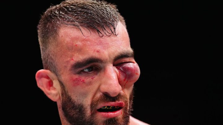 Dana White comparte una horrible foto de lesiones de Mohammad Yahya de UFC Abu Dhabi