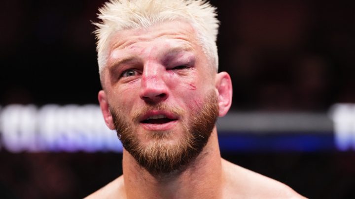 Mire la reacción de Dan Hooker al ver la cara destrozada por primera vez después de la derrota de UFC Qatar ante Arman Tsarukyan