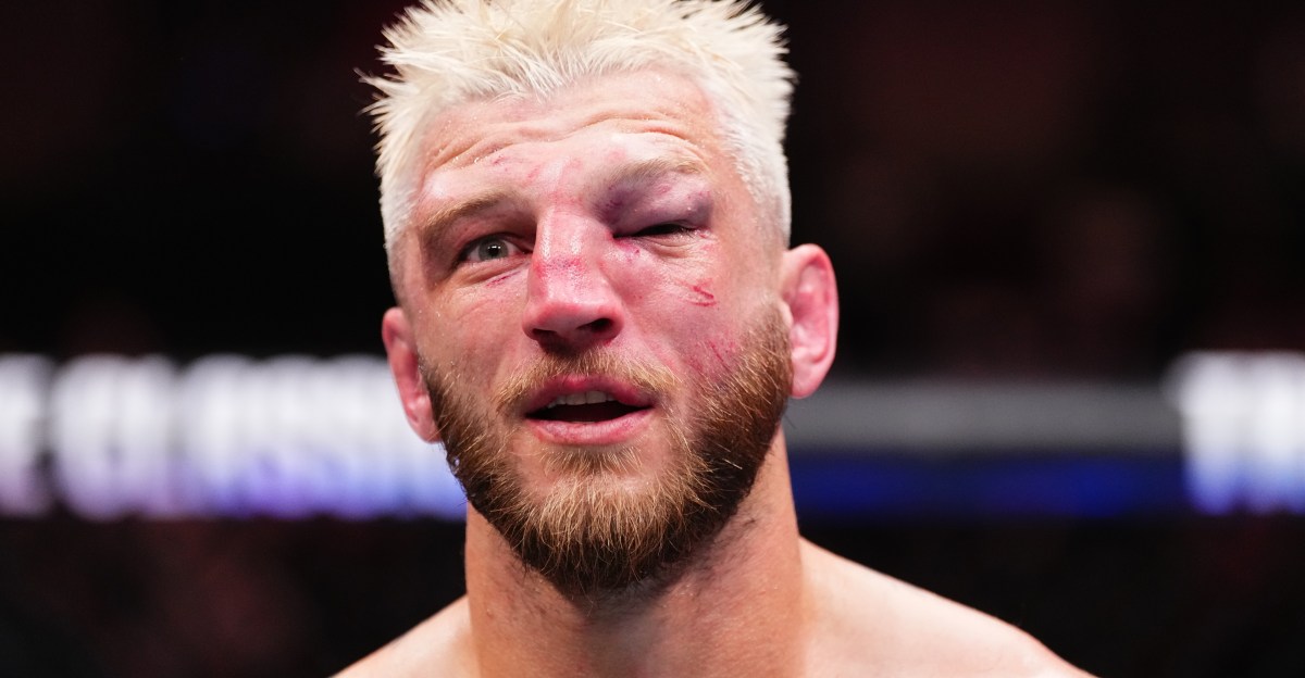 Mire la reacción de Dan Hooker al ver la cara destrozada por primera vez después de la derrota de UFC Qatar ante Arman Tsarukyan