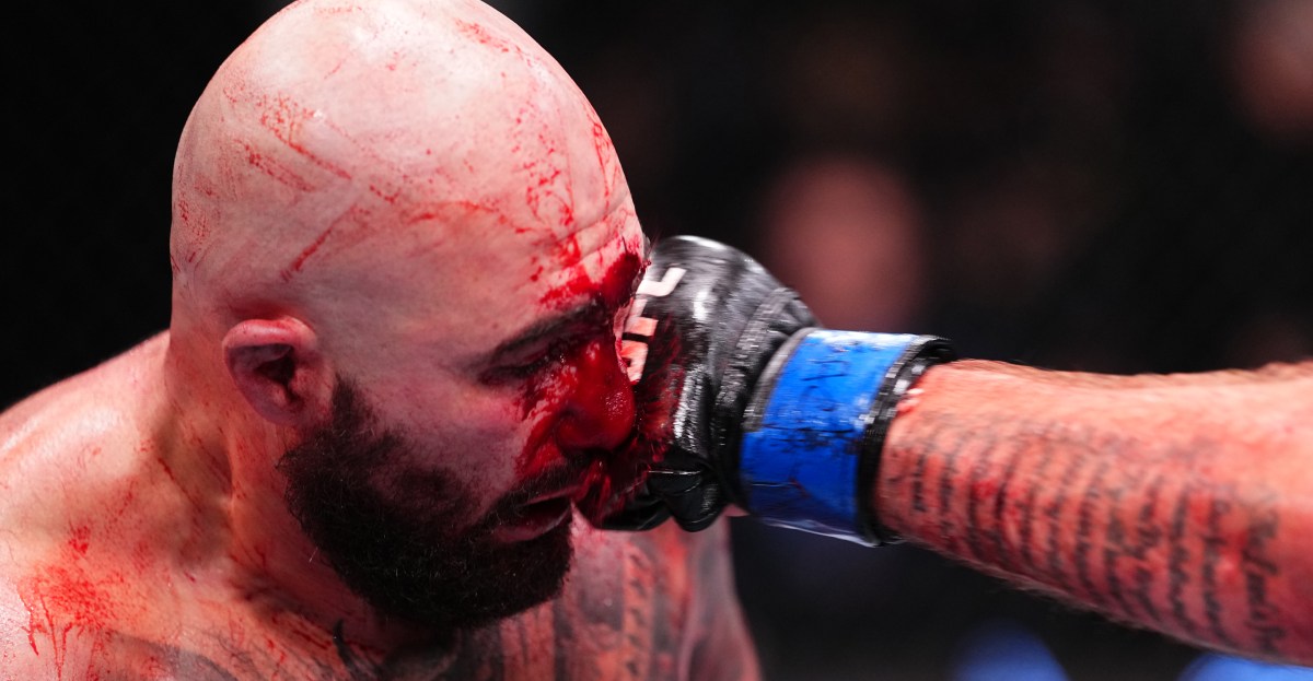 Dana White comparte los horribles cortes del peso pesado después de la derrota por nocaut en UFC Vegas 112