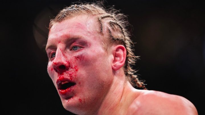Dana White comparte una retorcida foto del rostro de Paddy Pimblett después de UFC 324