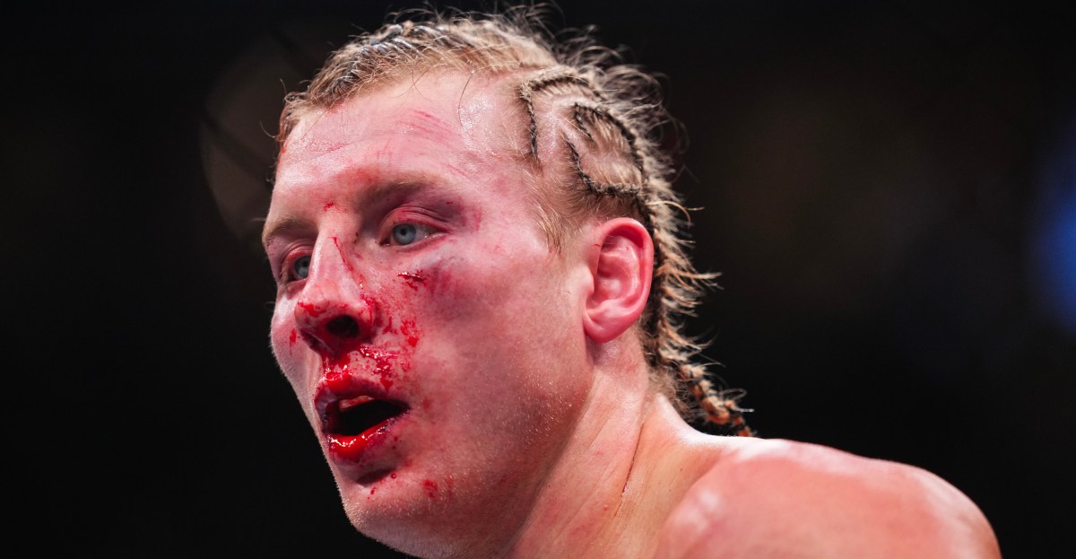 Dana White comparte una retorcida foto del rostro de Paddy Pimblett después de UFC 324