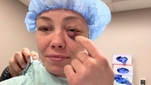 Rose Namajunas se somete a una cirugía después de que la 'pincharan en el ojo varias veces' en UFC 324