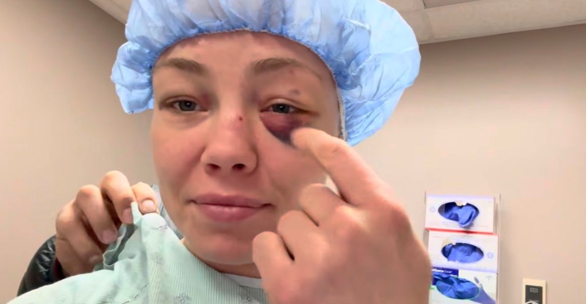 Rose Namajunas se somete a una cirugía después de que la 'pincharan en el ojo varias veces' en UFC 324